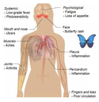 A few of many arthritis symptoms.